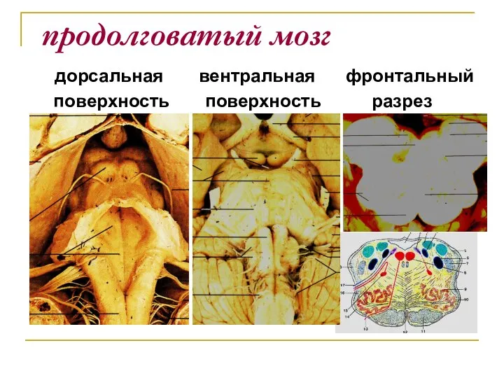 продолговатый мозг дорсальная вентральная фронтальный поверхность поверхность разрез