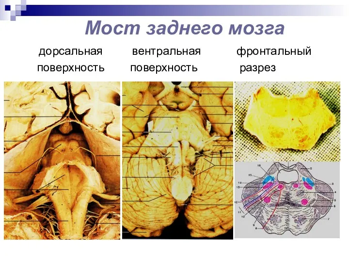 Мост заднего мозга дорсальная вентральная фронтальный поверхность поверхность разрез