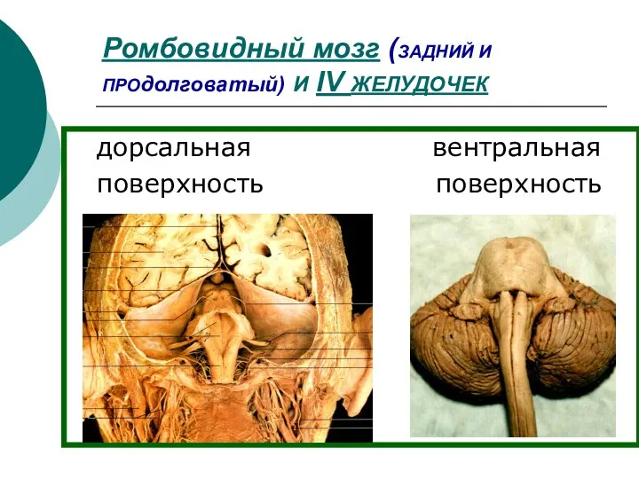 Ромбовидный мозг (ЗАДНИЙ И ПРОдолговатый) И IV ЖЕЛУДОЧЕК дорсальная вентральная поверхность поверхность