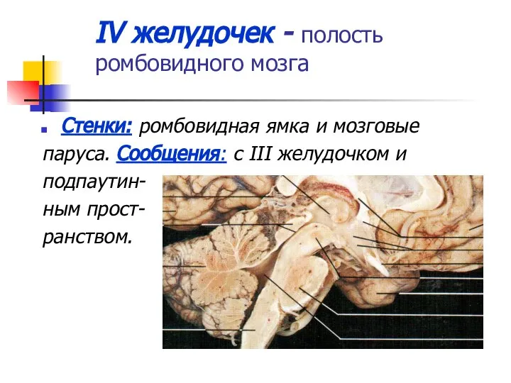 IV желудочек - полость ромбовидного мозга Стенки: ромбовидная ямка и мозговые