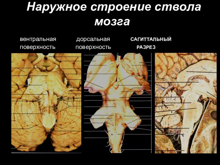 Наружное строение ствола мозга вентральная дорсальная САГИТТАЛЬНЫЙ поверхность поверхность РАЗРЕЗ