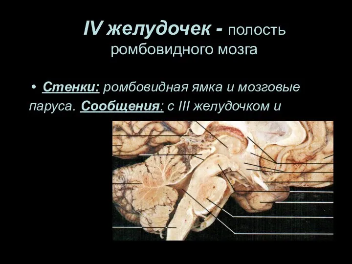 IV желудочек - полость ромбовидного мозга Стенки: ромбовидная ямка и мозговые