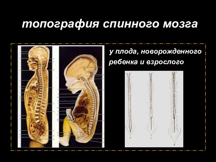 топография спинного мозга у плода, новорожденного ребенка и взрослого у