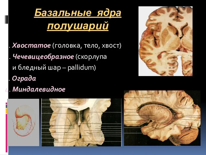 Базальные ядра полушарий 1. Хвостатое (головка, тело, хвост) 2. Чечевицеобразное (скорлупа