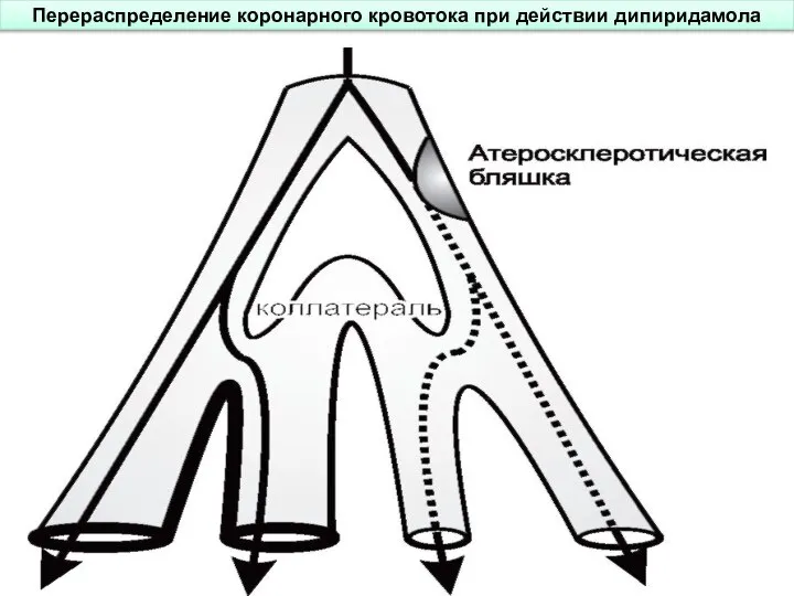 Перераспределение коронарного кровотока при действии дипиридамола