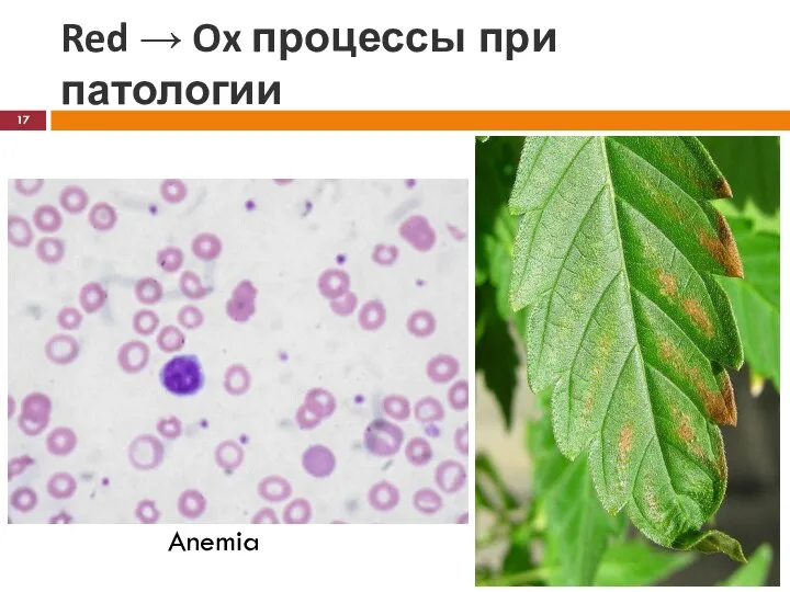 Red → Ox процессы при патологии Anemia