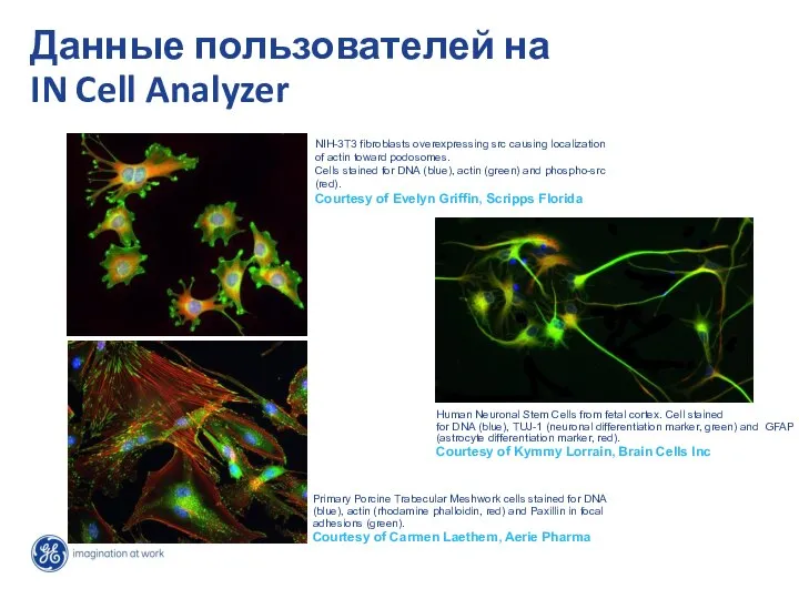 Данные пользователей на IN Cell Analyzer NIH-3T3 fibroblasts overexpressing src causing