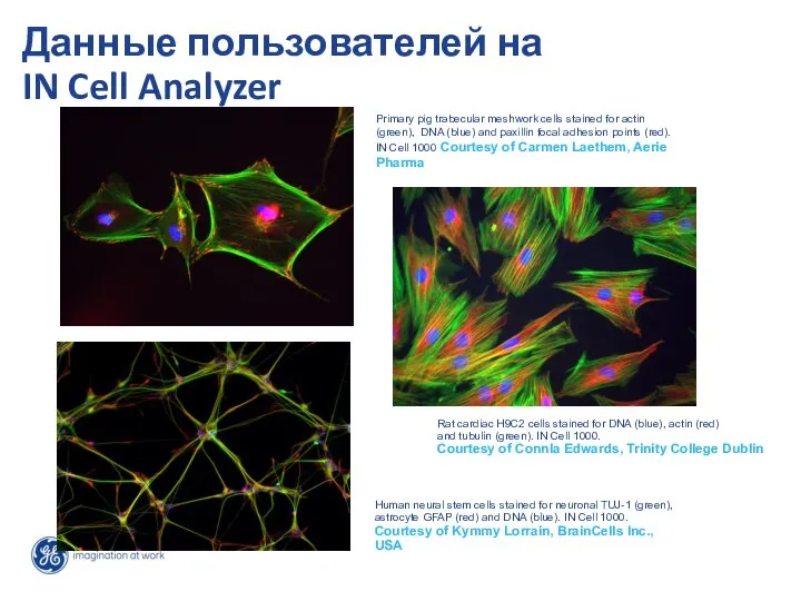 Данные пользователей на IN Cell Analyzer Primary pig trabecular meshwork cells