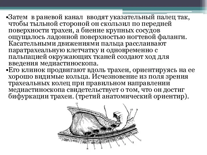 Затем в раневой канал вводят указательный палец так, чтобы тыльной стороной