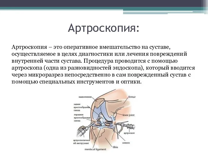 Артроскопия: Артроскопия – это оперативное вмешательство на суставе, осуществляемое в целях