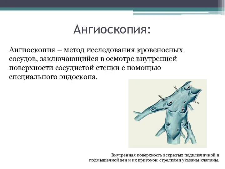 Ангиоскопия: Ангиоскопия – метод исследования кровеносных сосудов, заключающийся в осмотре внутренней