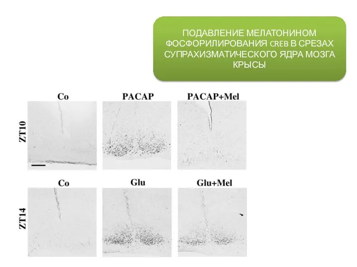 ПОДАВЛЕНИЕ МЕЛАТОНИНОМ ФОСФОРИЛИРОВАНИЯ CREB В СРЕЗАХ СУПРАХИЗМАТИЧЕСКОГО ЯДРА МОЗГА КРЫСЫ