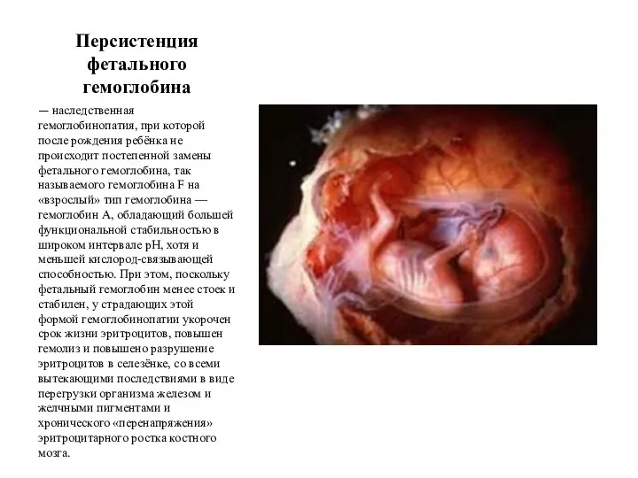 Персистенция фетального гемоглобина — наследственная гемоглобинопатия, при которой после рождения ребёнка