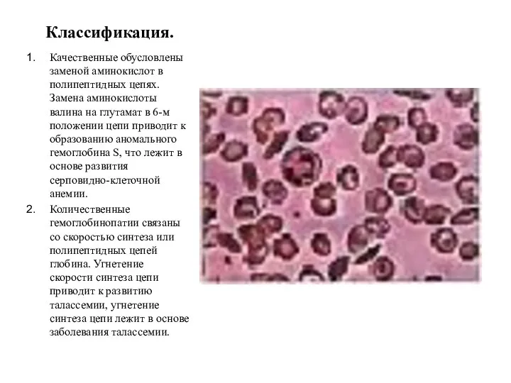 Классификация. Качественные обусловлены заменой аминокислот в полипептидных цепях. Замена аминокислоты валина