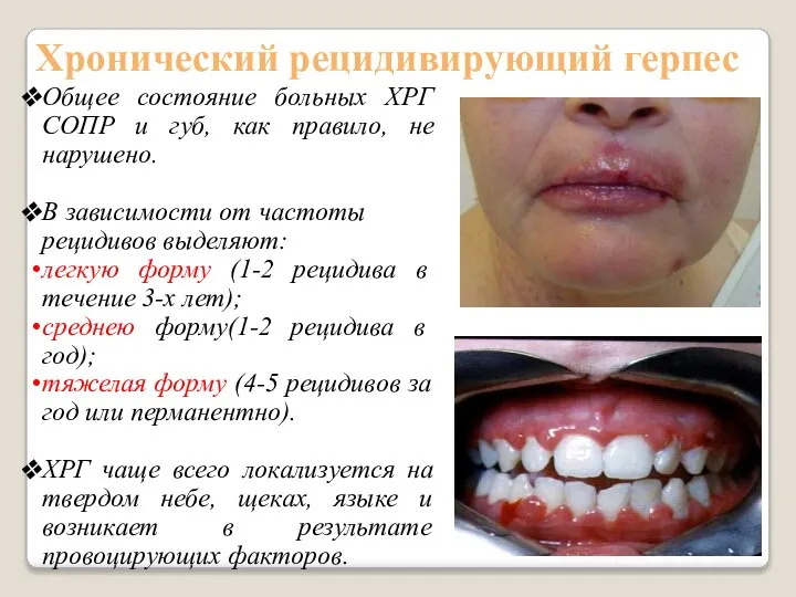Общее состояние больных ХРГ СОПР и губ, как правило, не нарушено.