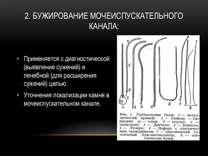 2. БУЖИРОВАНИЕ МОЧЕИСПУСКАТЕЛЬНОГО КАНАЛА: Применяется с диагностической (выявление сужений) и лечебной