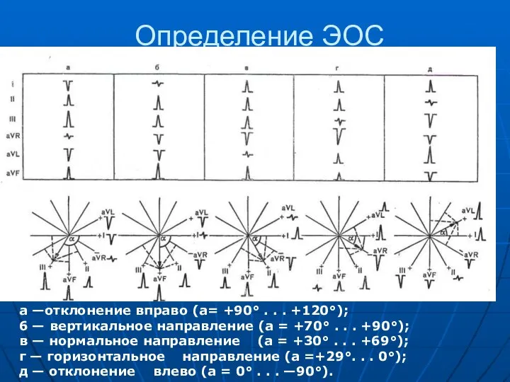 Определение ЭОС а —отклонение вправо (а= +90° . . . +120°);