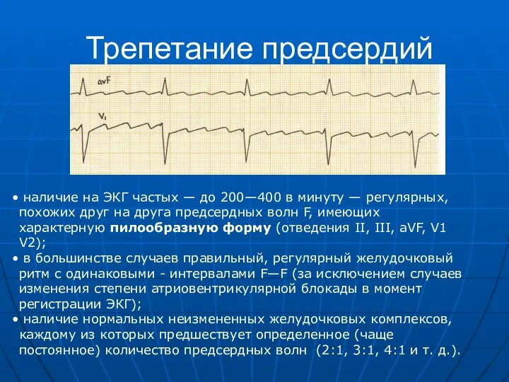 Трепетание предсердий наличие на ЭКГ частых — до 200—400 в минуту