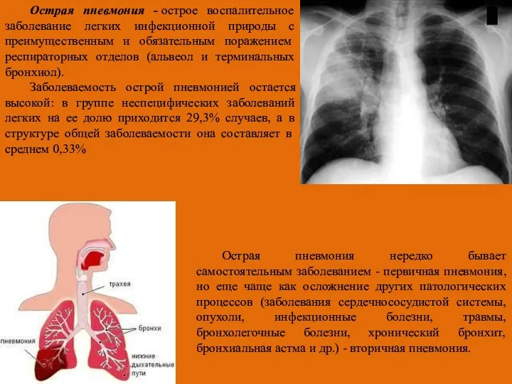 Острая пневмония нередко бывает самостоятельным заболеванием - первичная пневмония, но еще