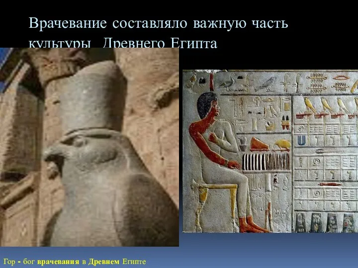 Врачевание составляло важную часть культуры Древнего Египта Гор - бог врачевания в Древнем Египте