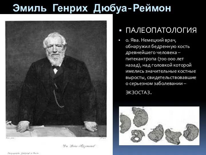 Эмиль Генрих Дюбуа-Реймон 1818-1896 ПАЛЕОПАТОЛОГИЯ о. Ява. Немецкий врач, обнаружил бедренную