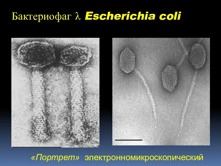 Бактериофаг λ Escherichia coli «Портрет» электронномикроскопический