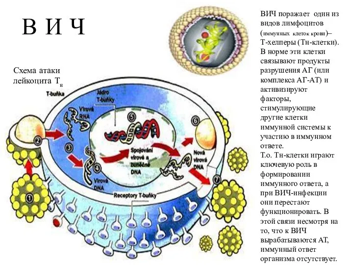 ВИЧ поражает один из видов лимфоцитов (иммунных клеток крови)– Т-хелперы (Тн-клетки).