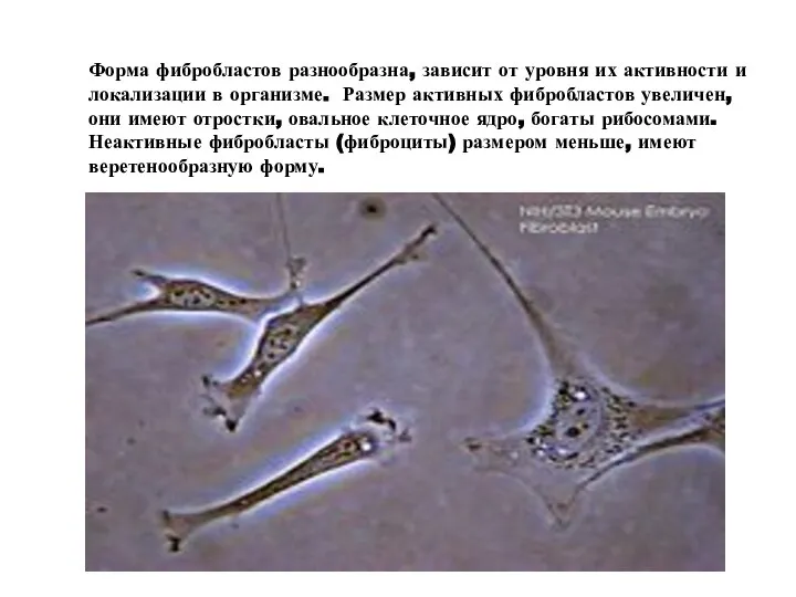Форма фибробластов разнообразна, зависит от уровня их активности и локализации в