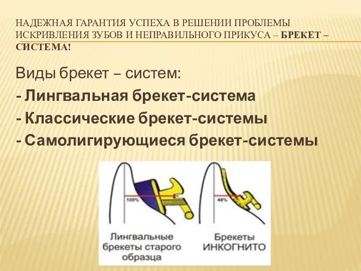 НАДЕЖНАЯ ГАРАНТИЯ УСПЕХА В РЕШЕНИИ ПРОБЛЕМЫ ИСКРИВЛЕНИЯ ЗУБОВ И НЕПРАВИЛЬНОГО ПРИКУСА