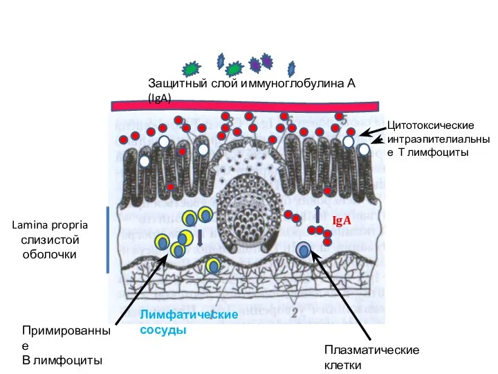 Защитный слой иммуноглобулина А (IgA) Цитотоксические интраэпителиальные Т лимфоциты Плазматические клетки