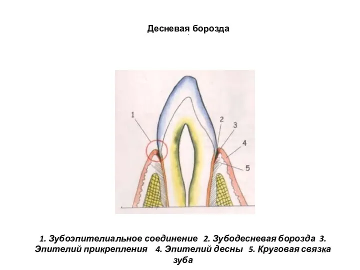 Десневая борозда 5. 1. Зубоэпителиальное соединение 2. Зубодесневая борозда 3. Эпителий