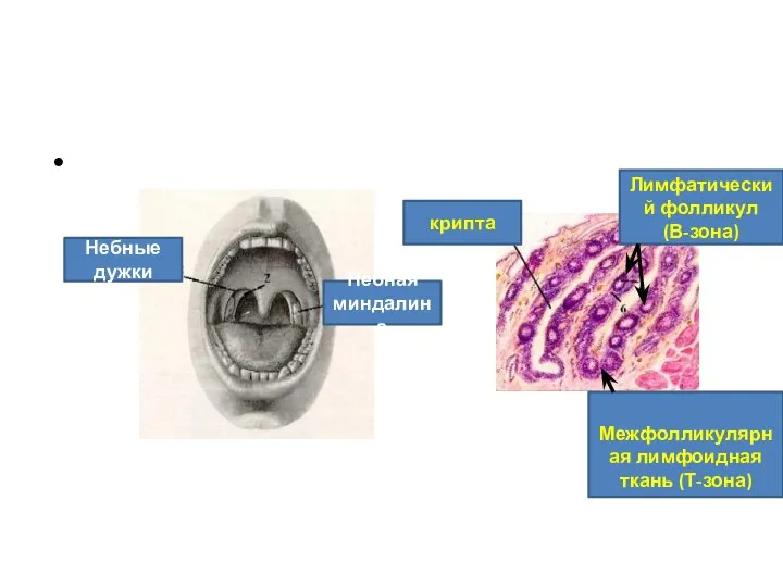 Небные дужки Небная миндалина крипта Лимфатический фолликул (В-зона) Межфолликулярная лимфоидная ткань (Т-зона)