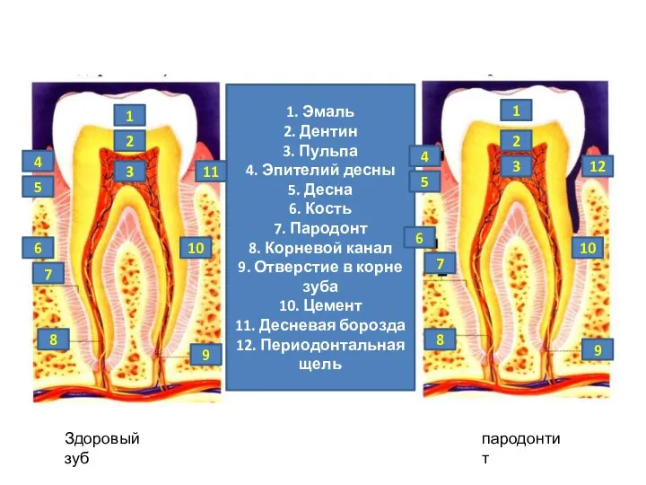 1. Эмаль 2. Дентин 3. Пульпа 4. Эпителий десны 5. Десна