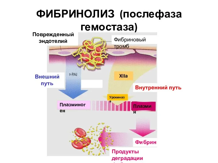 ФИБРИНОЛИЗ (послефаза гемостаза) Поврежденный эндотелий Фибриновый тромб Плазминоген Плазмин Внутренний путь