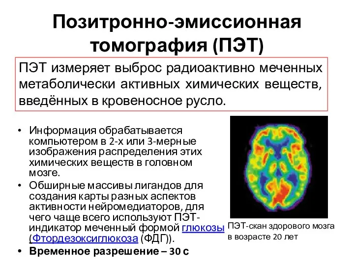 Позитронно-эмиссионная томография (ПЭТ) Информация обрабатывается компьютером в 2-х или 3-мерные изображения