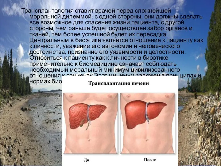 Трансплантология ставит врачей перед сложнейшей моральной дилеммой: с одной стороны, они