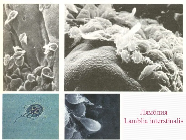 Лямблия Lamblia interstinalis