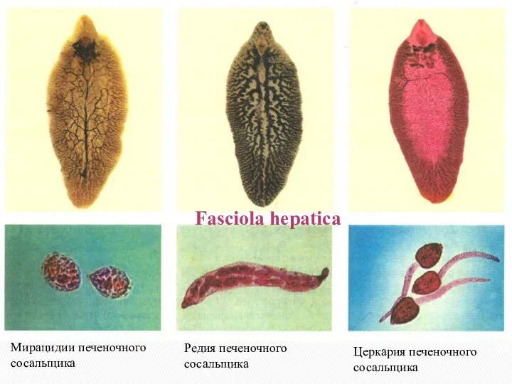 Fasciola hepatica Мирацидии печеночного сосальщика Редия печеночного сосальщика Церкария печеночного сосальщика