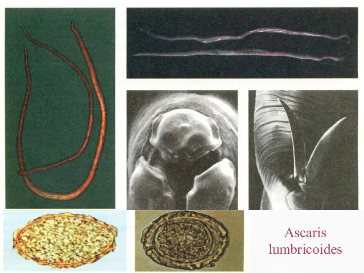 Ascaris lumbricoides