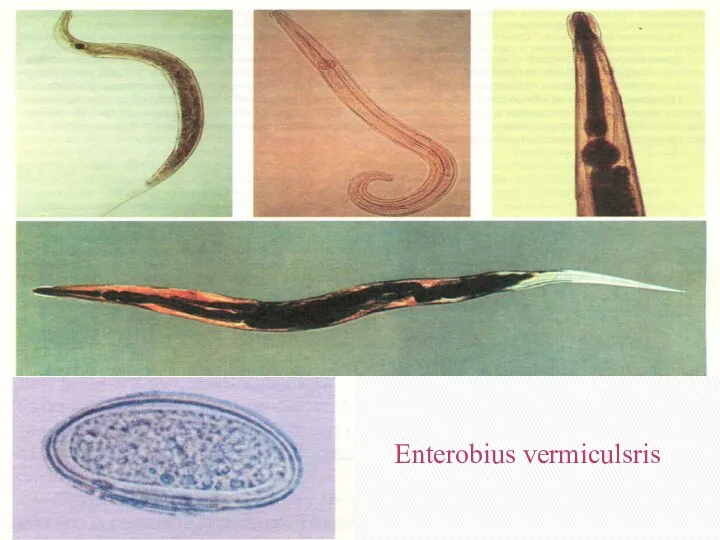 Enterobius vermiculsris