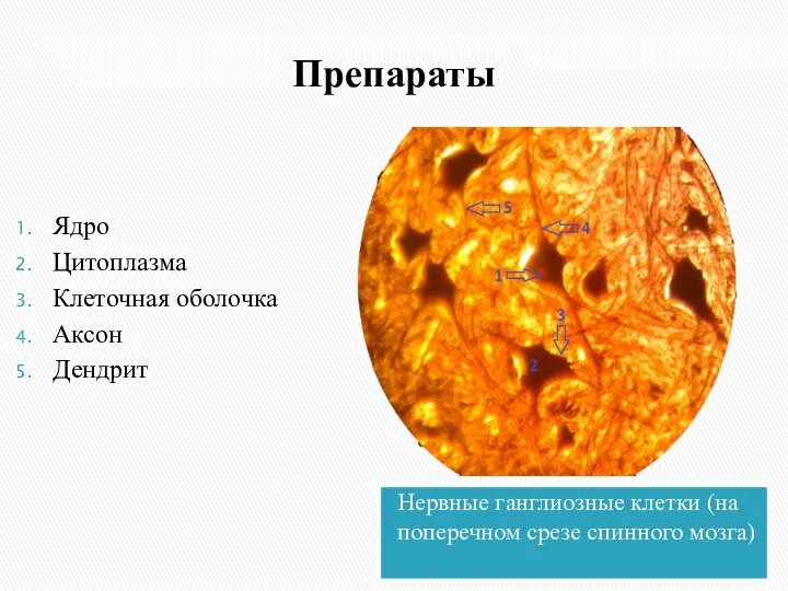 Препараты Нервные ганглиозные клетки (на поперечном срезе спинного мозга) Ядро Цитоплазма Клеточная оболочка Аксон Дендрит