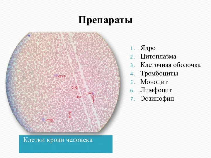 Препараты Клетки крови человека Ядро Цитоплазма Клеточная оболочка Тромбоциты Моноцит Лимфоцит Эозинофил