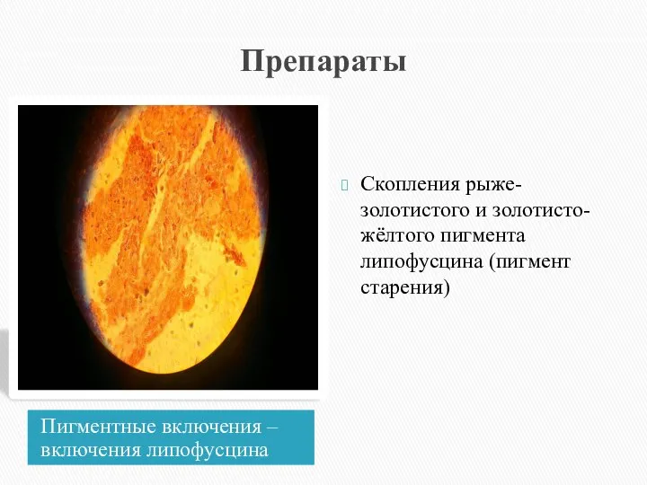 Препараты Пигментные включения – включения липофусцина Скопления рыже-золотистого и золотисто-жёлтого пигмента липофусцина (пигмент старения)