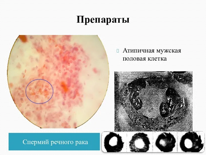 Препараты Спермий речного рака Атипичная мужская половая клетка