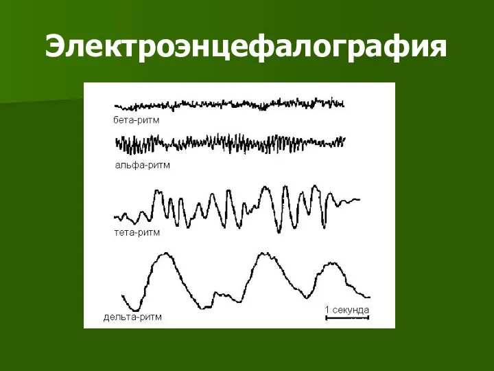 Электроэнцефалография