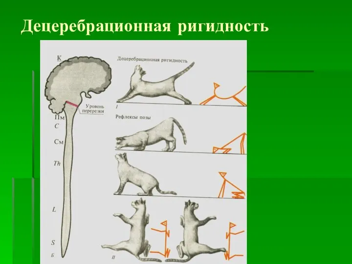 Децеребрационная ригидность