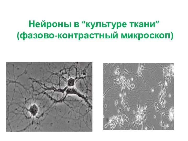 Нейроны в “культуре ткани” (фазово-контрастный микроскоп)