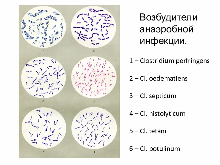 Возбудители анаэробной инфекции. 1 – Clostridium perfringens 2 – Cl. oedematiens
