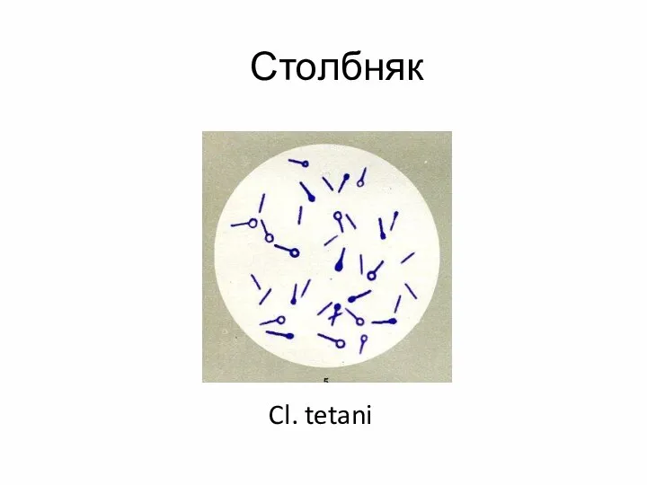 Столбняк Cl. tetani