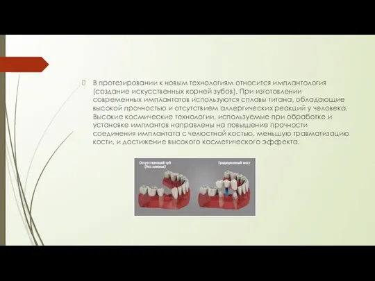 В протезировании к новым технологиям относится имплантология (создание искусственных корней зубов).